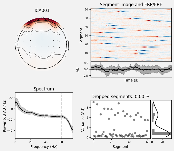 _images/train_network_eeg_1_247.png