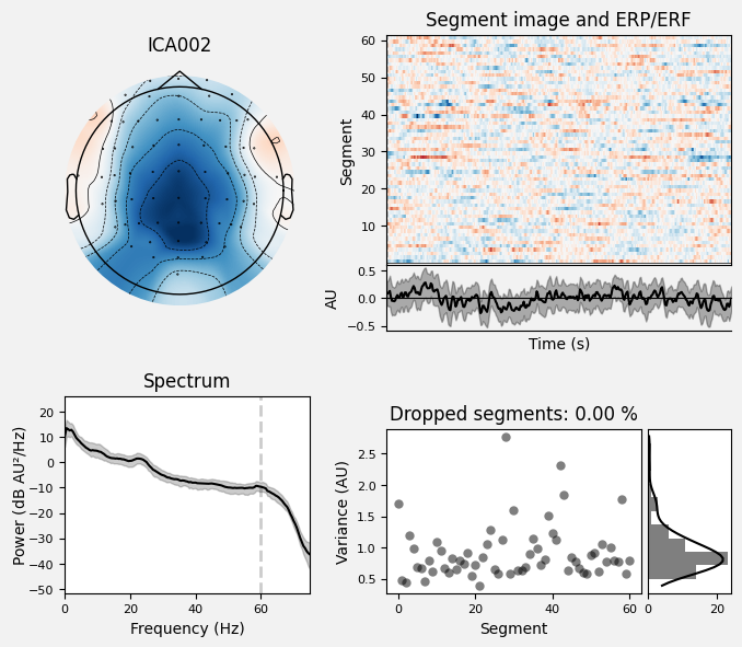 _images/train_network_eeg_1_248.png