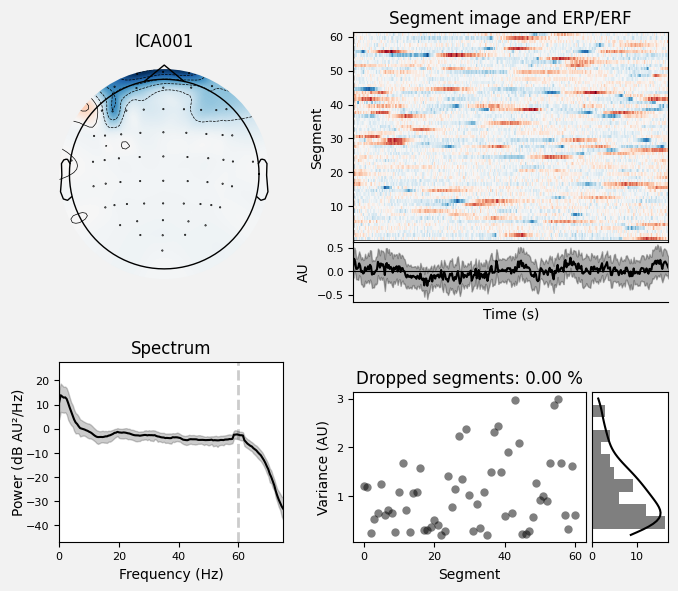 _images/train_network_eeg_1_254.png