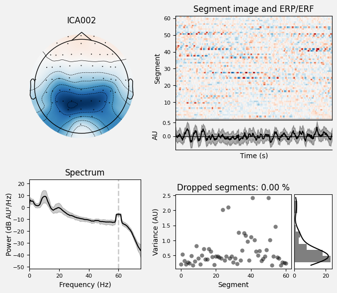 _images/train_network_eeg_1_255.png