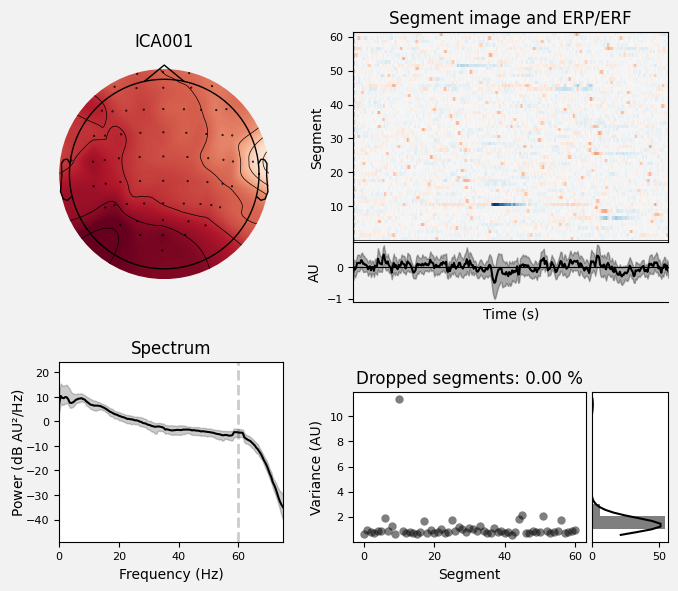 _images/train_network_eeg_1_259.png