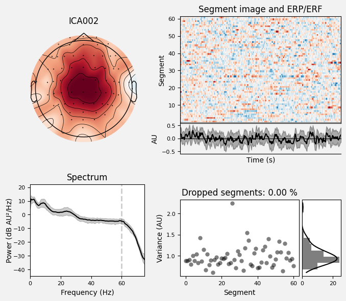 _images/train_network_eeg_1_260.png