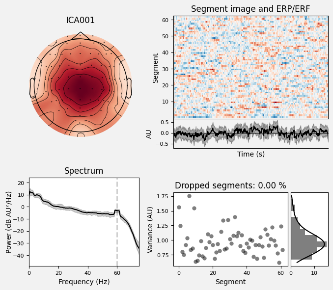 _images/train_network_eeg_1_264.png