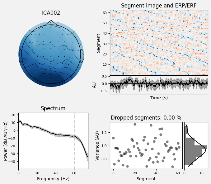_images/train_network_eeg_1_265.png