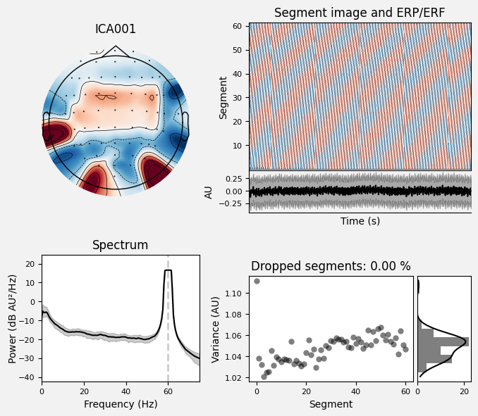 _images/train_network_eeg_1_27.png