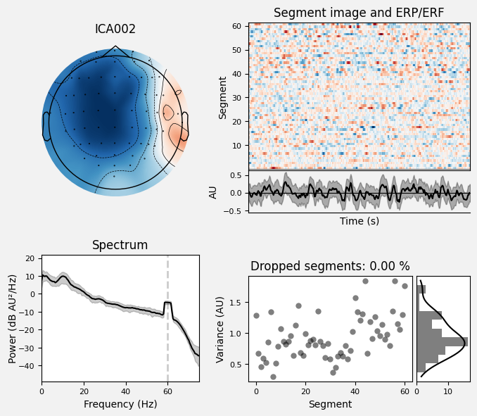 _images/train_network_eeg_1_272.png