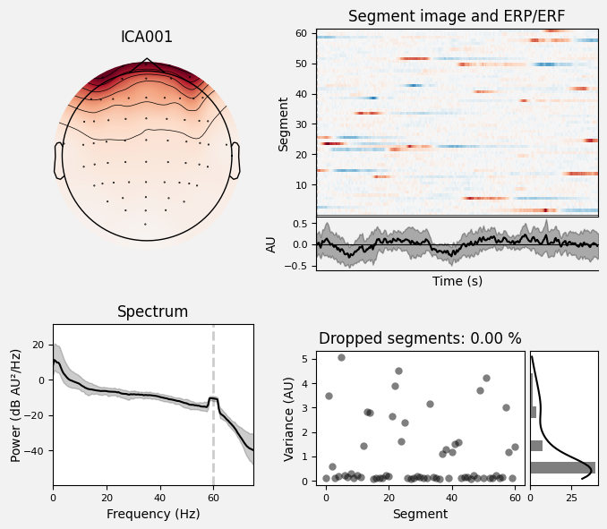 _images/train_network_eeg_1_278.png