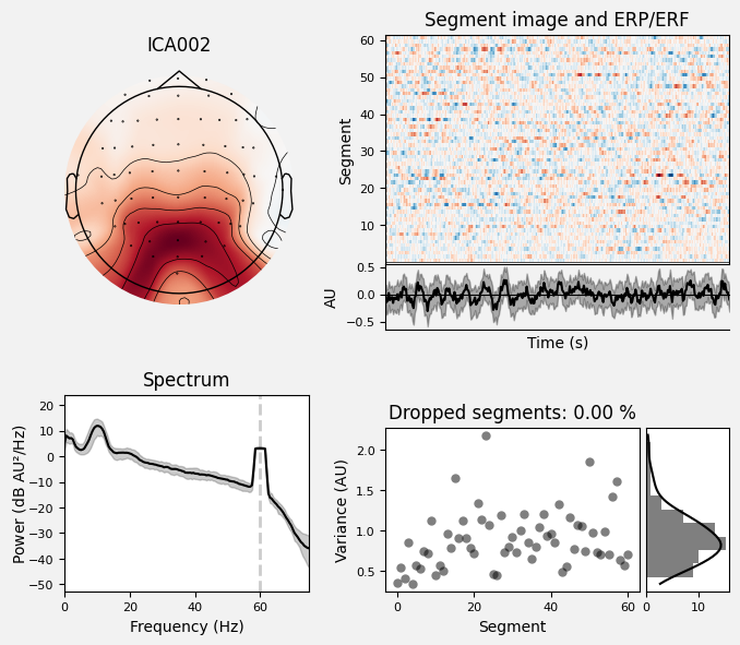 _images/train_network_eeg_1_279.png
