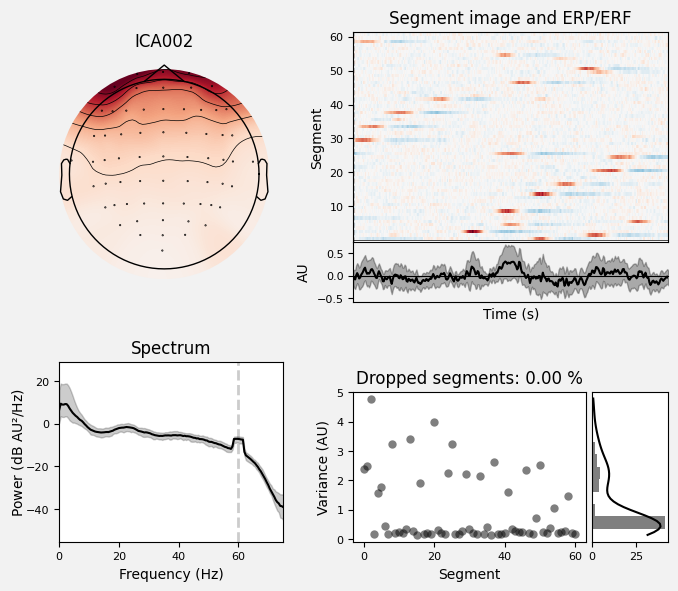 _images/train_network_eeg_1_28.png