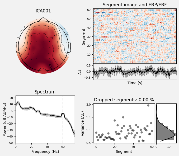 _images/train_network_eeg_1_283.png