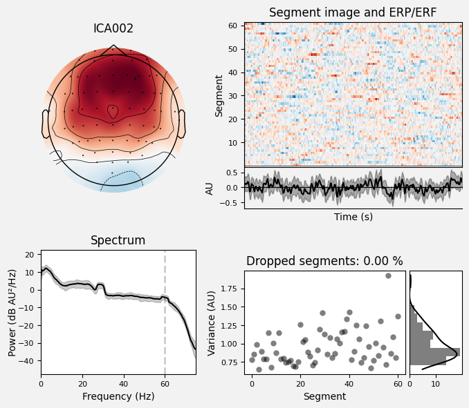_images/train_network_eeg_1_284.png