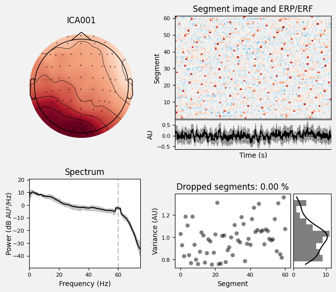 _images/train_network_eeg_1_288.png