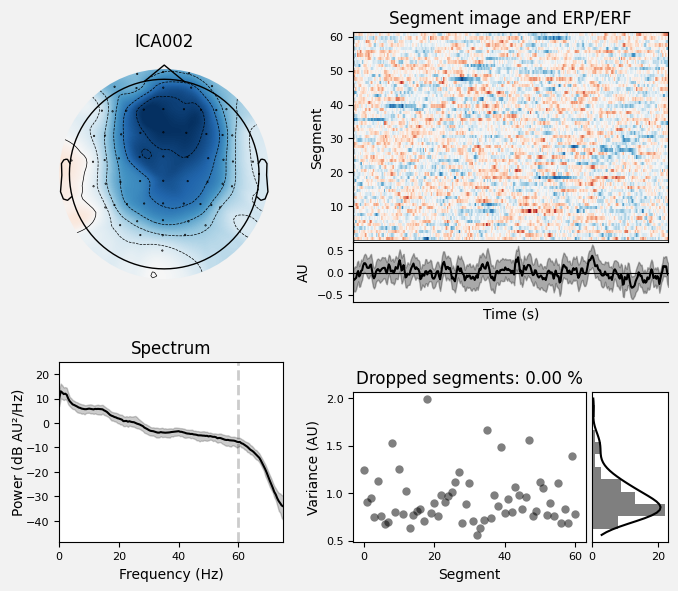 _images/train_network_eeg_1_289.png