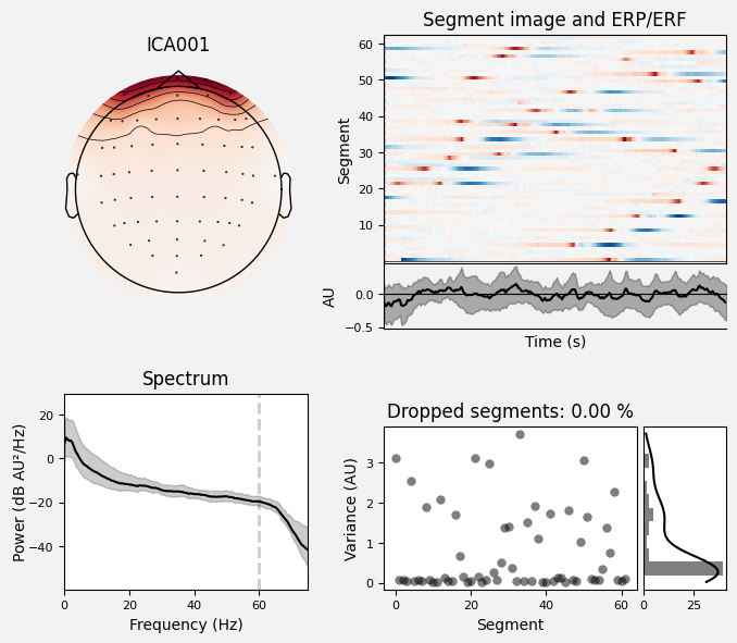 _images/train_network_eeg_1_295.png