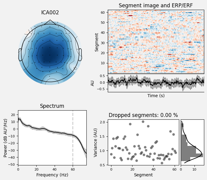 _images/train_network_eeg_1_296.png