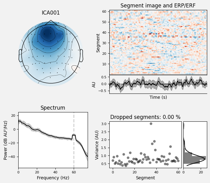 _images/train_network_eeg_1_302.png