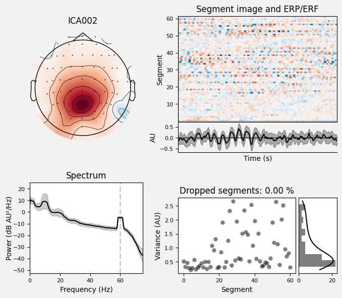 _images/train_network_eeg_1_303.png