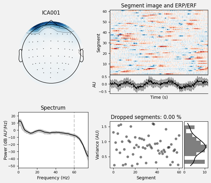 _images/train_network_eeg_1_309.png