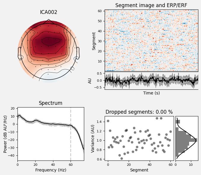 _images/train_network_eeg_1_310.png