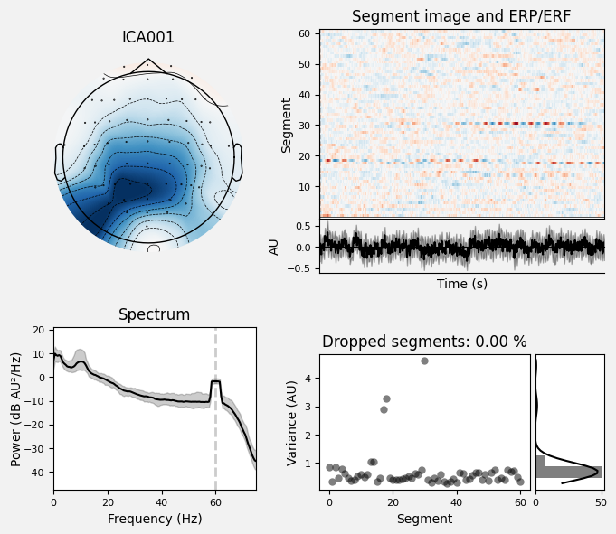 _images/train_network_eeg_1_314.png