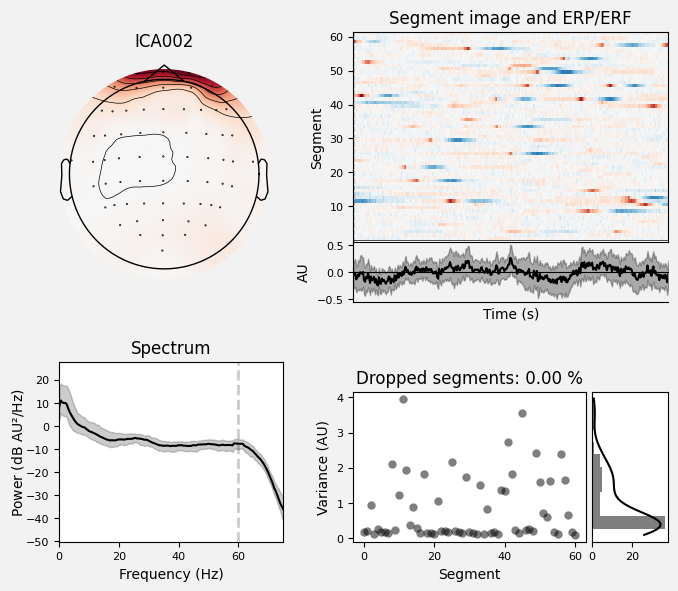 _images/train_network_eeg_1_315.png