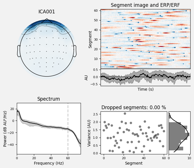 _images/train_network_eeg_1_321.png