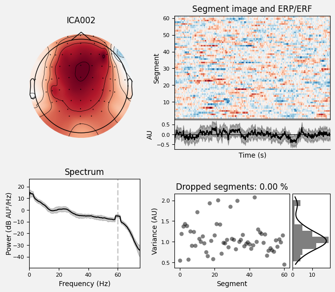 _images/train_network_eeg_1_322.png