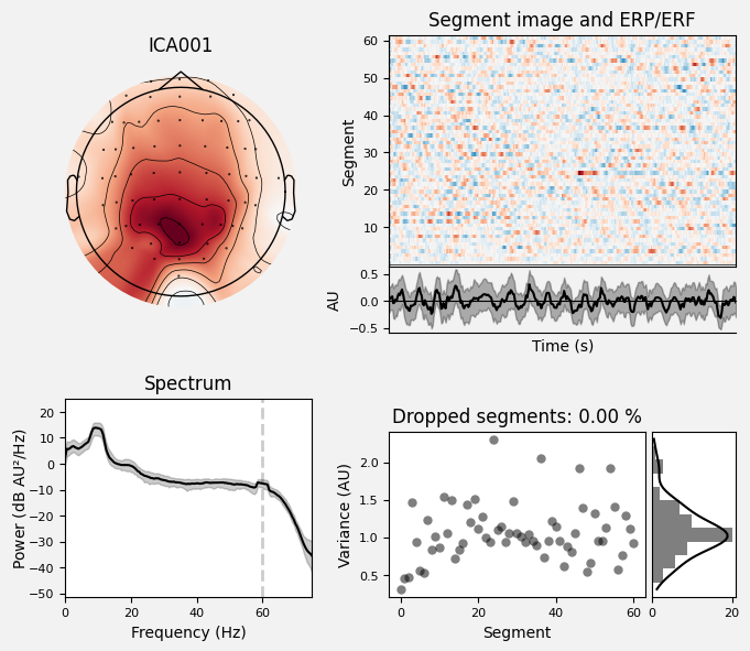 _images/train_network_eeg_1_326.png