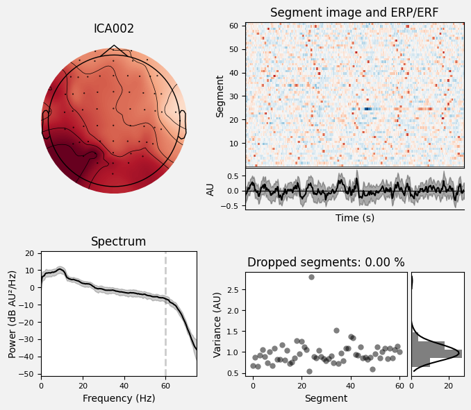 _images/train_network_eeg_1_327.png