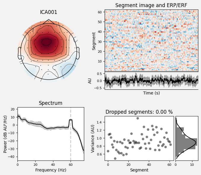 _images/train_network_eeg_1_333.png