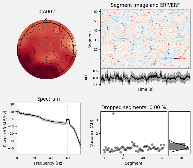 _images/train_network_eeg_1_334.png
