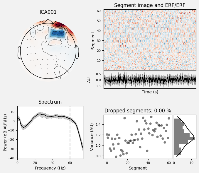 _images/train_network_eeg_1_338.png