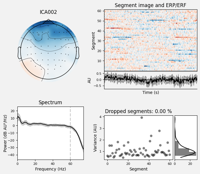 _images/train_network_eeg_1_339.png