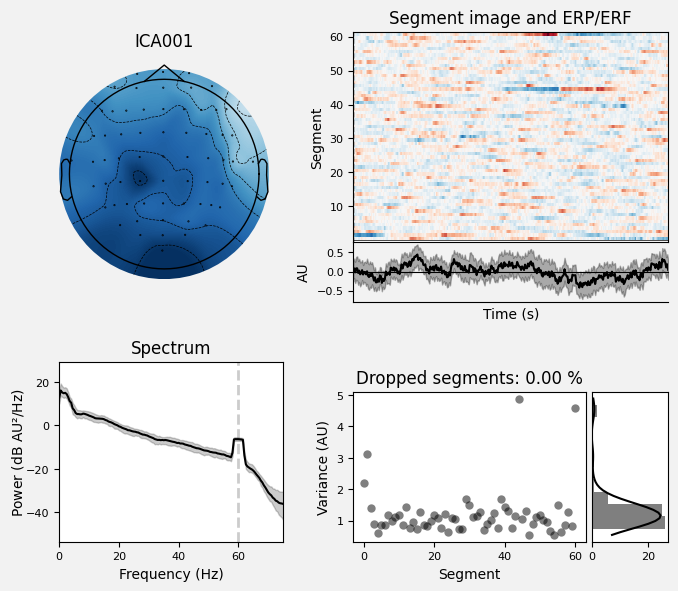 _images/train_network_eeg_1_343.png
