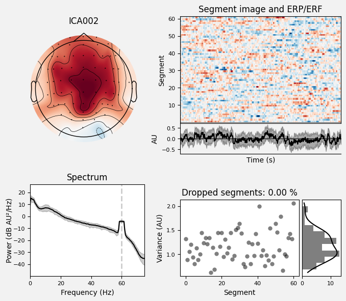 _images/train_network_eeg_1_344.png