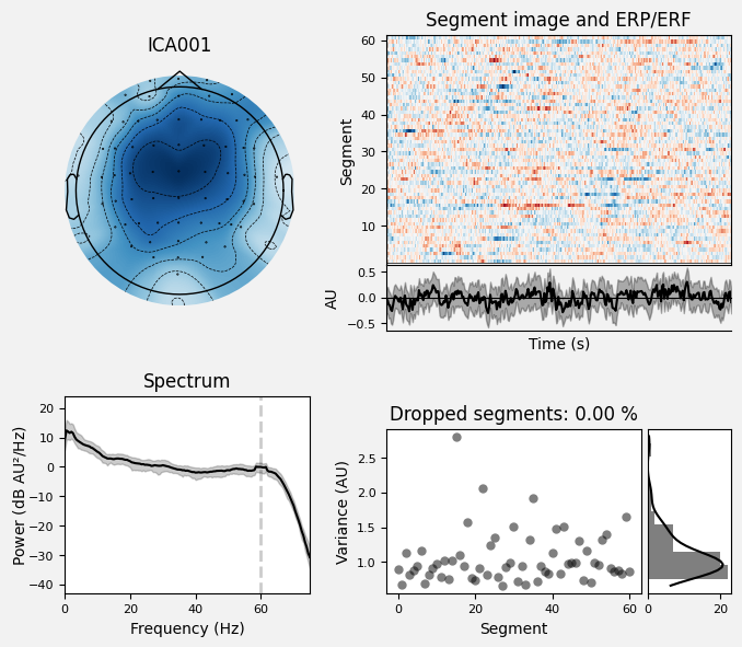 _images/train_network_eeg_1_348.png
