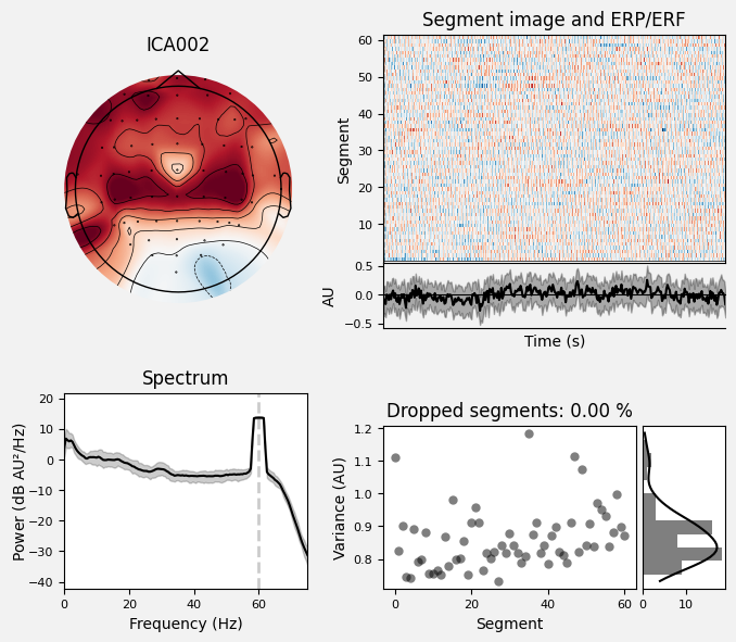 _images/train_network_eeg_1_349.png