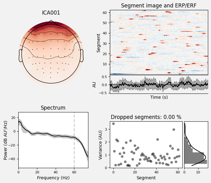_images/train_network_eeg_1_353.png
