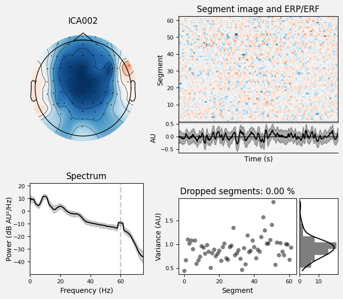 _images/train_network_eeg_1_354.png