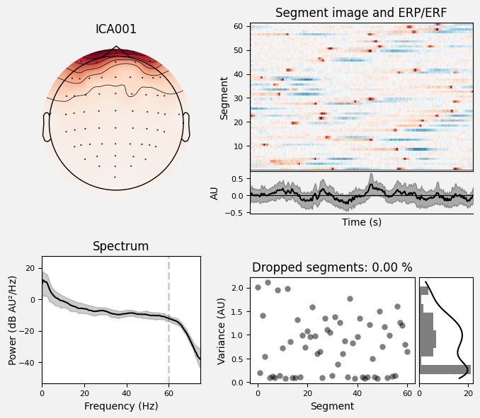_images/train_network_eeg_1_360.png