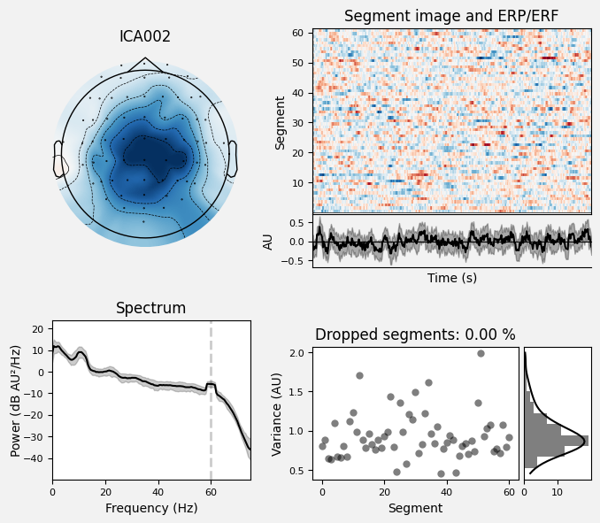 _images/train_network_eeg_1_361.png