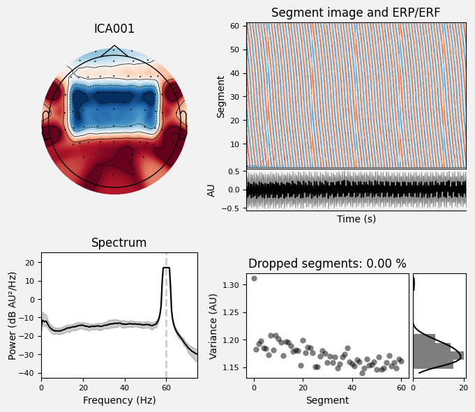 _images/train_network_eeg_1_367.png
