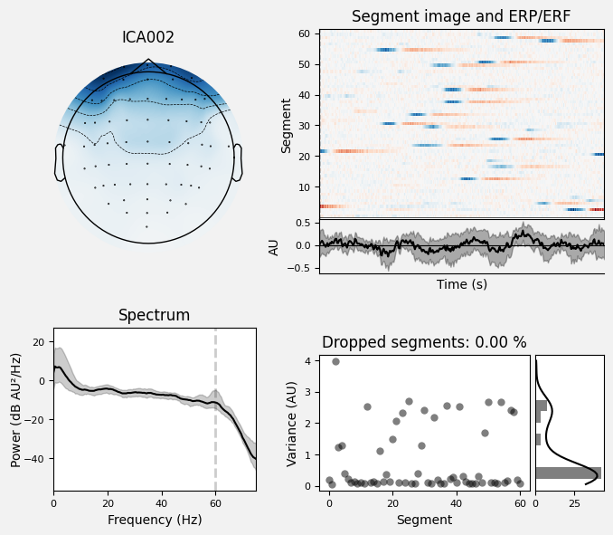 _images/train_network_eeg_1_368.png