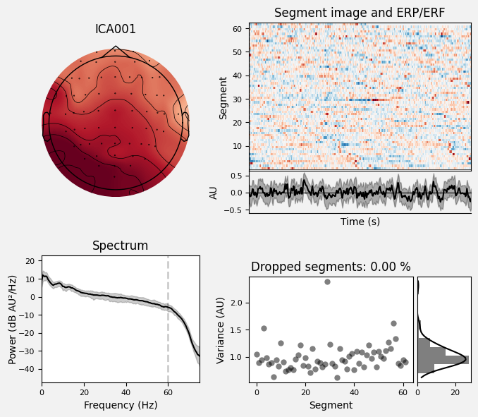 _images/train_network_eeg_1_374.png