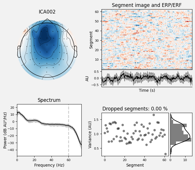 _images/train_network_eeg_1_375.png