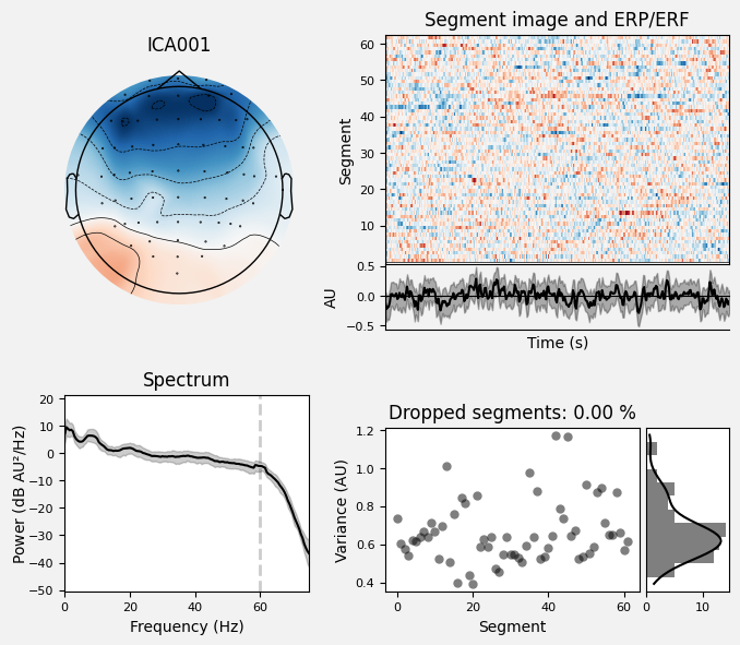 _images/train_network_eeg_1_379.png