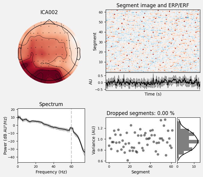 _images/train_network_eeg_1_380.png