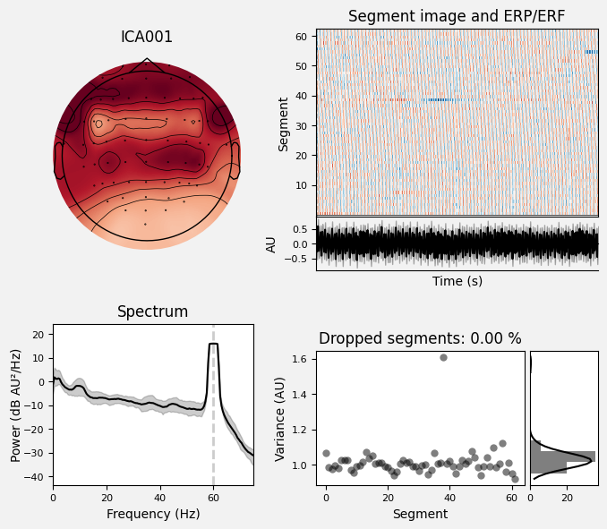 _images/train_network_eeg_1_384.png