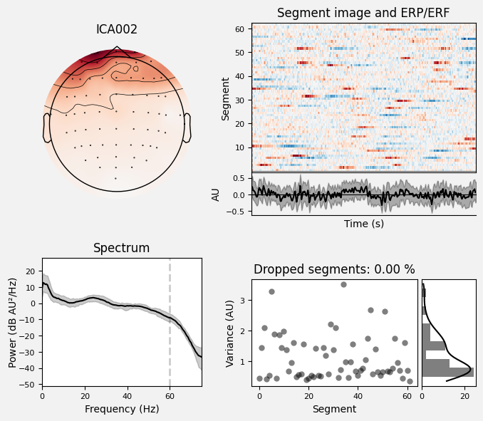 _images/train_network_eeg_1_385.png