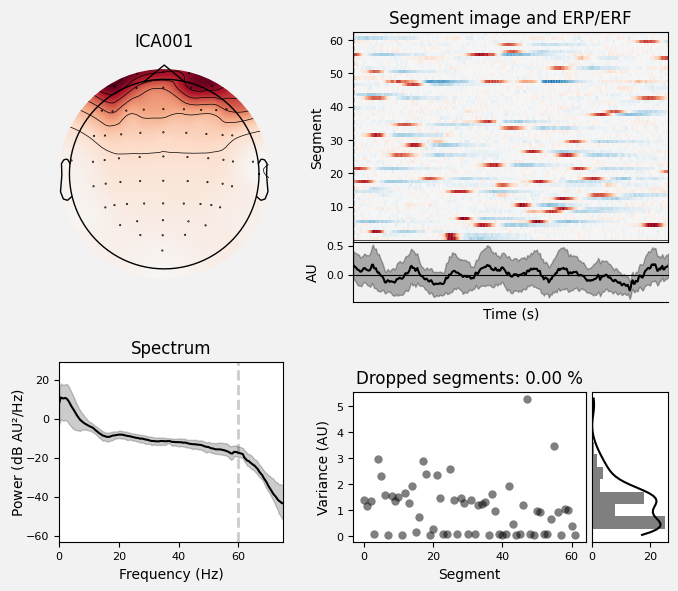 _images/train_network_eeg_1_39.png
